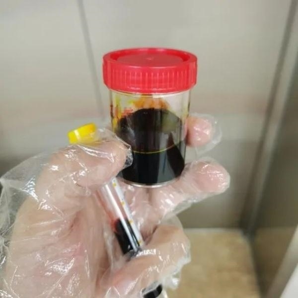 急性肝衰竭！兩兄弟誤吃這種菌 專家提醒